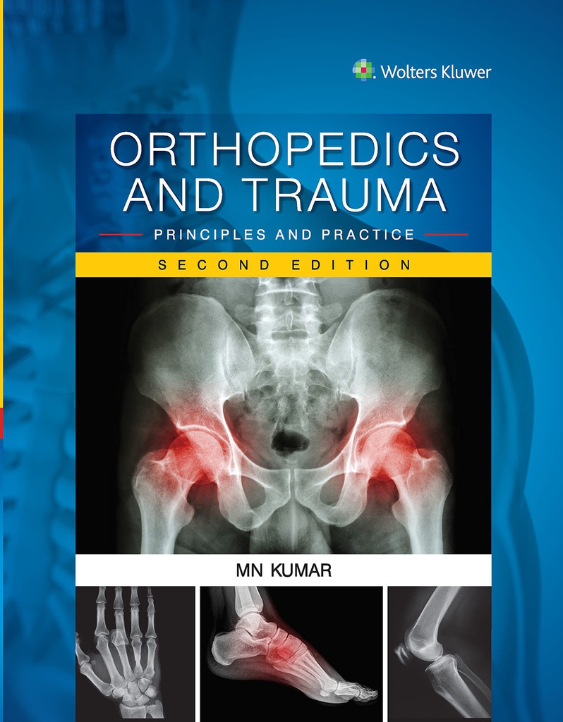 Orthopedics and Trauma: Principles and Practice, 2/e