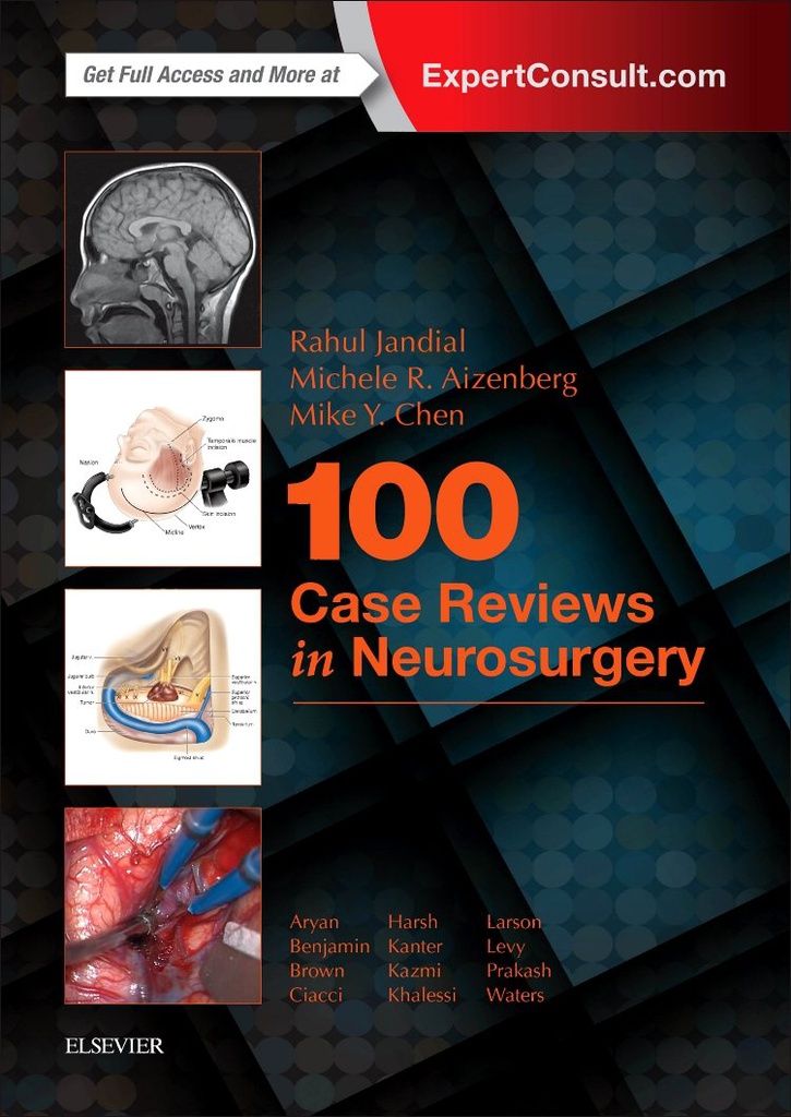 100 Case Reviews in Neurosurgery: 1ed