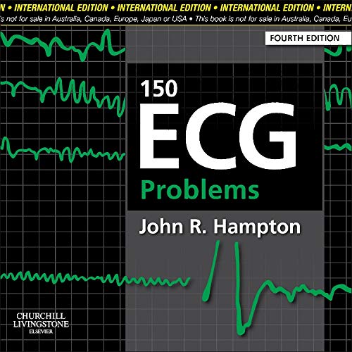 150 ECG Problems, IE, 4/e