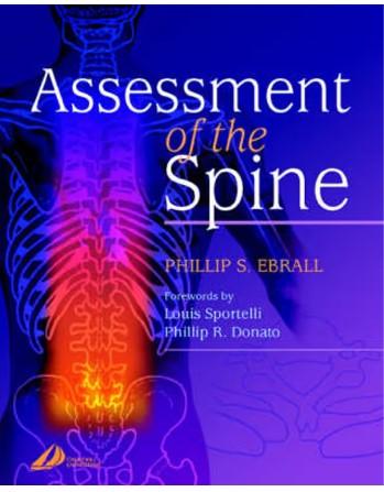 Assessment of the Spine: 1ed