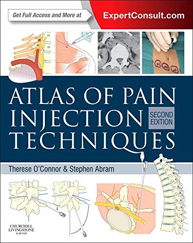 Atlas of Pain Injection Techniques: Expert Consult: Online and Print 2ed