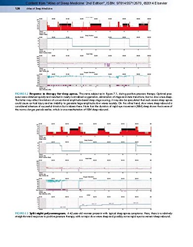 Atlas of Sleep Medicine: Expert Consult - Online and Print 2ed