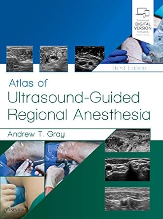 Atlas of Ultrasound-Guided Regional Anesthesia: 3ed