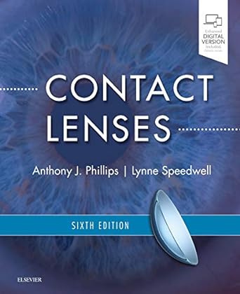 Contact Lenses: 6ed