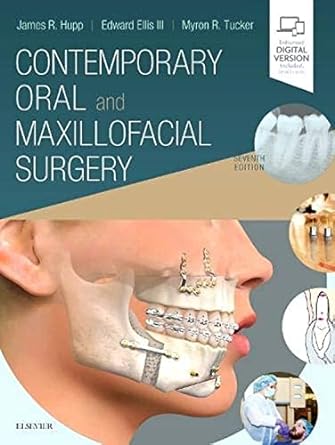 Contemporary Oral and Maxillofacial Surgery: 7ed