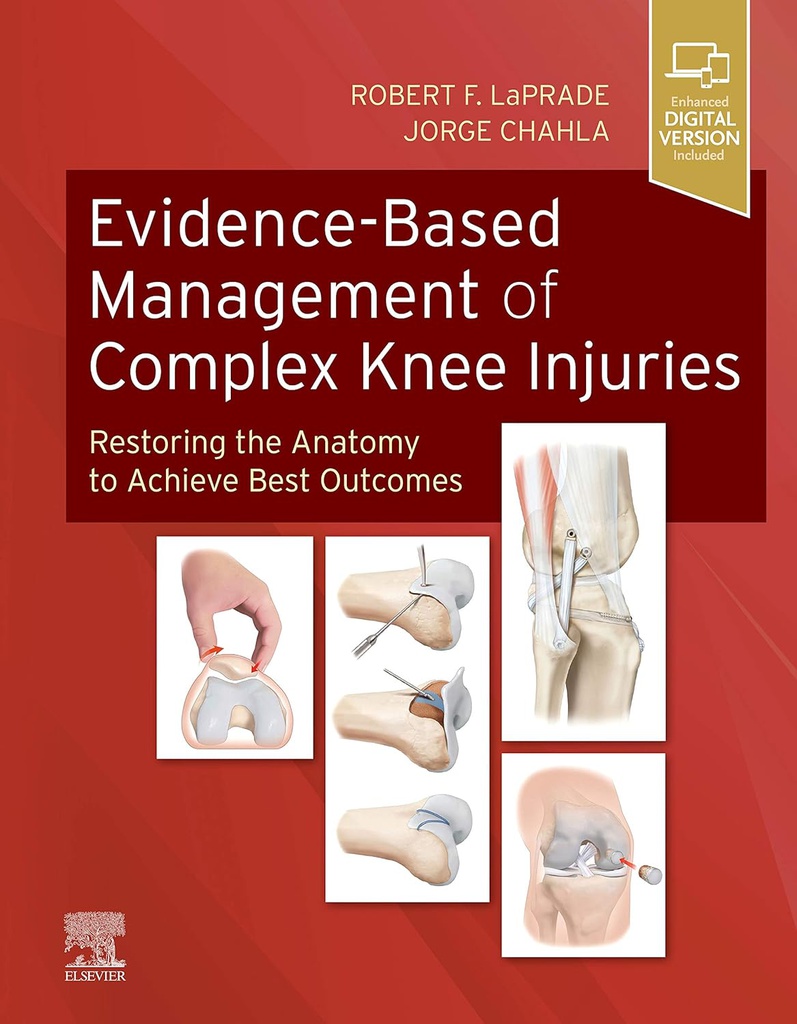 Evidence-Based Management of Complex Knee Injuries: Restoring the Anatomy to Achieve Best Outcomes 1ed