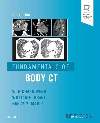 Fundamentals of Body CT: 5ed