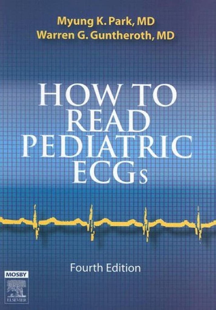 How to Read Pediatric ECGs: 4ed