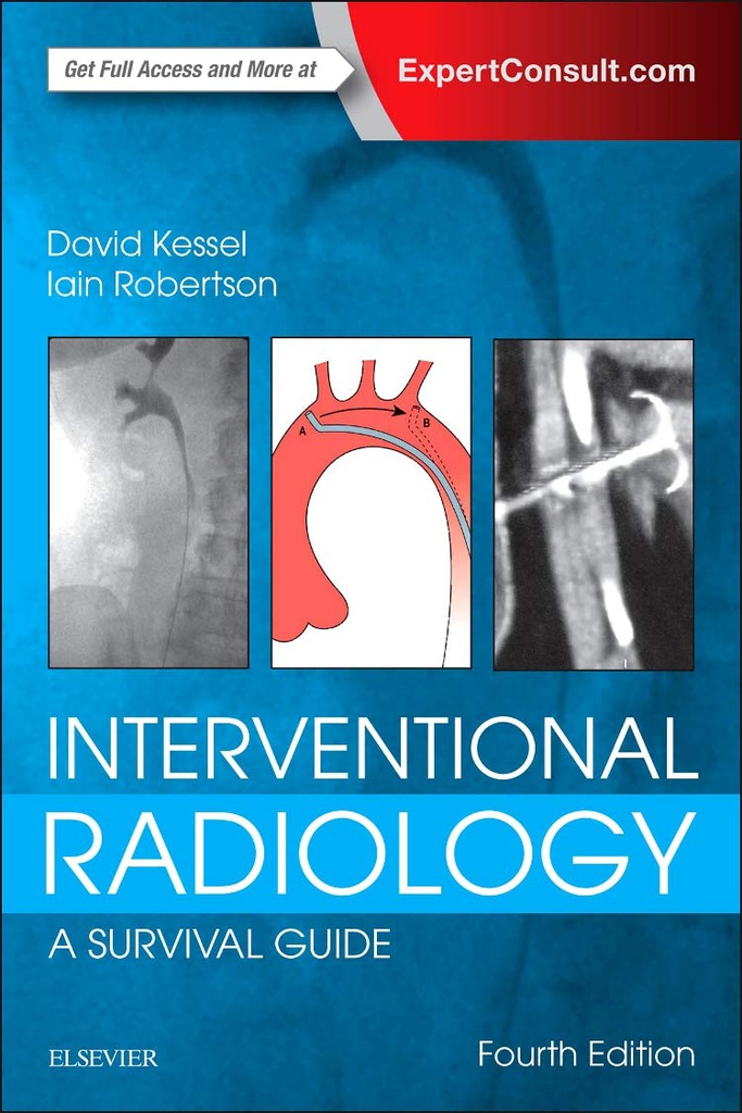 Interventional Radiology: A Survival Guide: 4ed