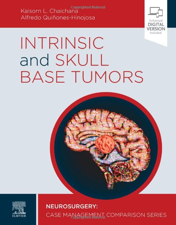 Intrinsic and Skull Base Tumors: Neurosurgery: Case Management Comparison Series 1ed