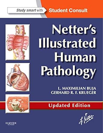 Netter's Illustrated Human Pathology Updated Edition: with Student Consult Access 1ed