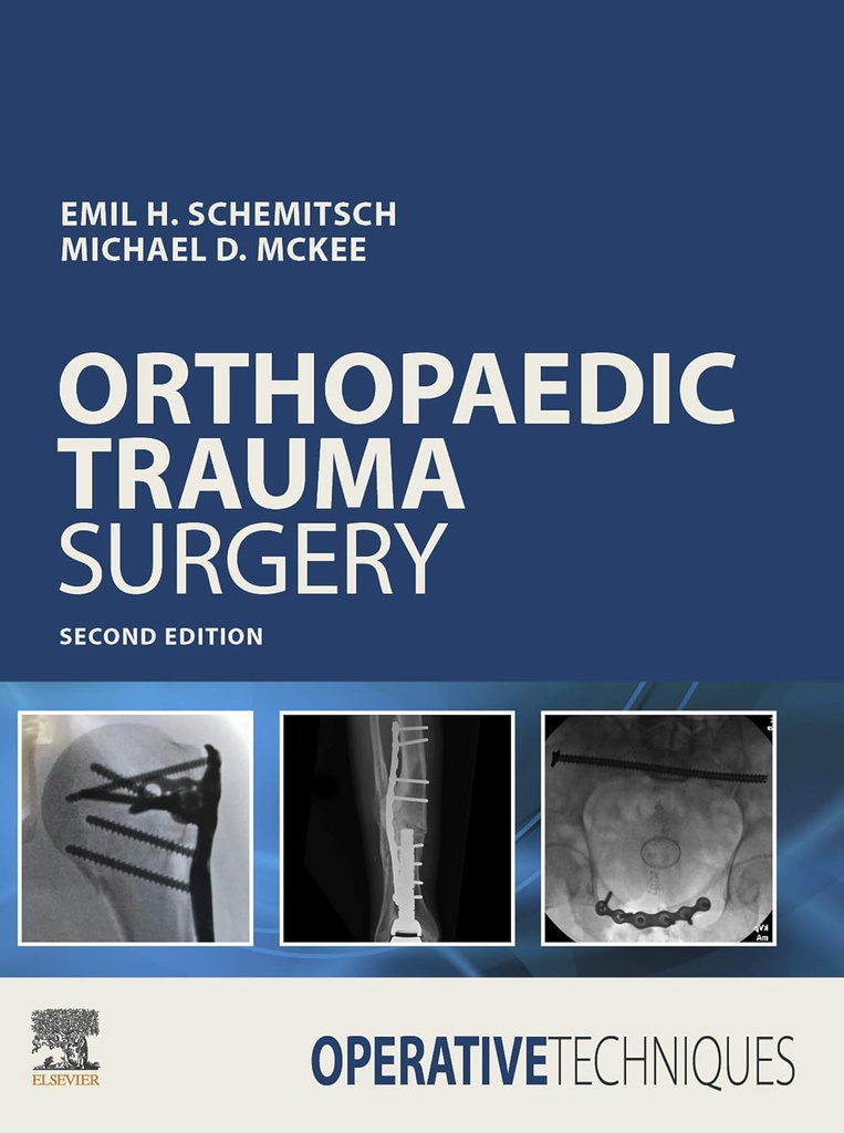 Operative Techniques: Orthopaedic Trauma Surgery: 2ed