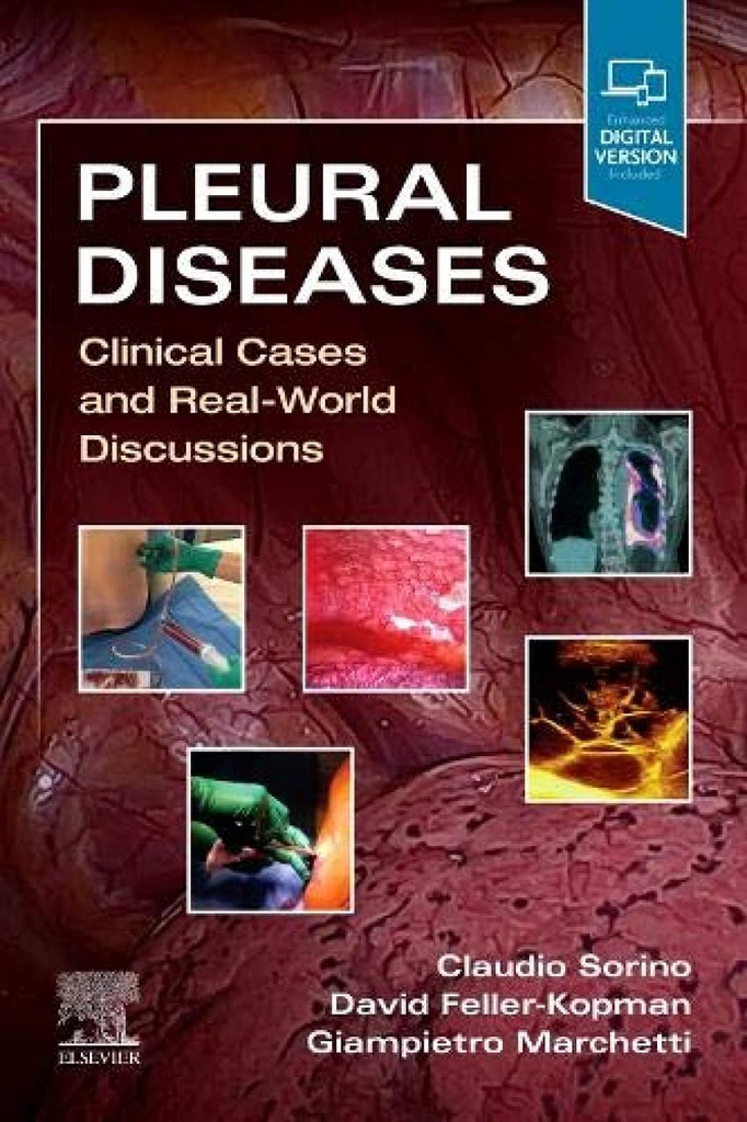 Pleural Diseases: Clinical Cases and Real-World Discussions 1ed