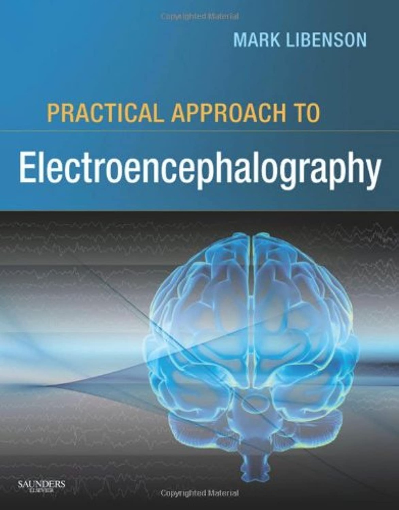 Practical Approach to Electroencephalography: 1ed