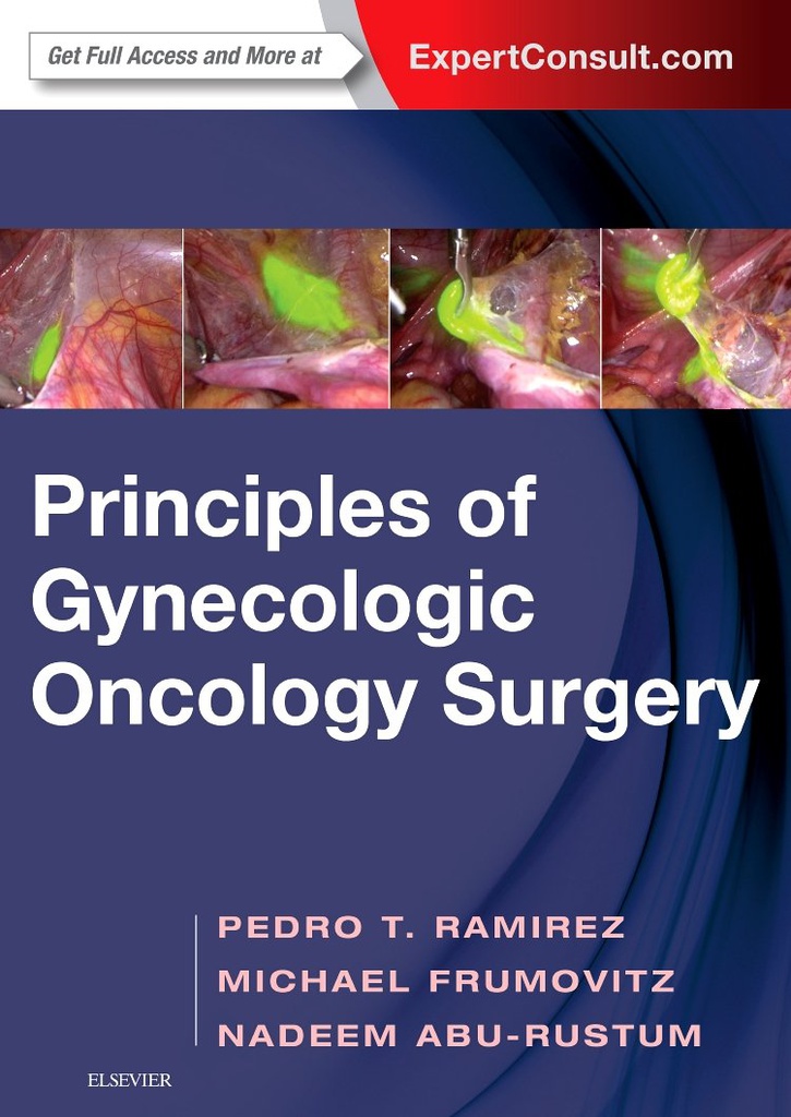 Principles of Gynecologic Oncology Surgery: 1ed