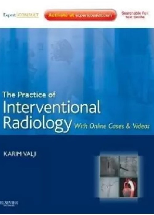 The Practice of Interventional Radiology, with online cases and video: Expert Consult Premium Edition - Enhanced Online Features and Print 1ed