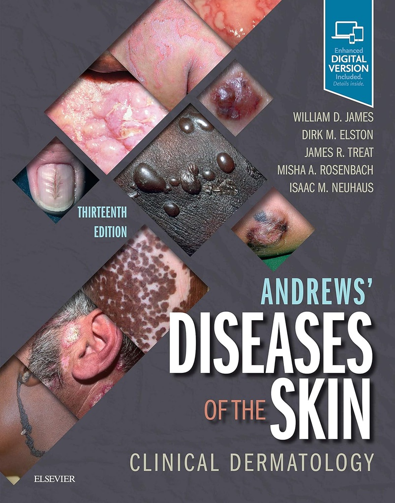 Andrews' Diseases of the Skin: Clinical Dermatology 13ed