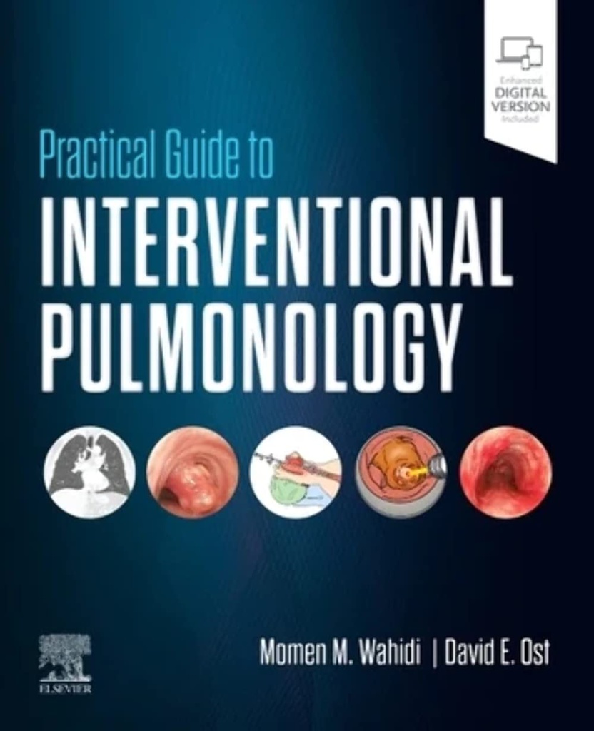 Practical Guide to Interventional Pulmonology: 1ed