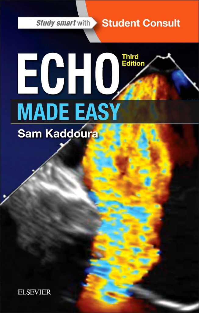 Echo Made Easy: 3ed