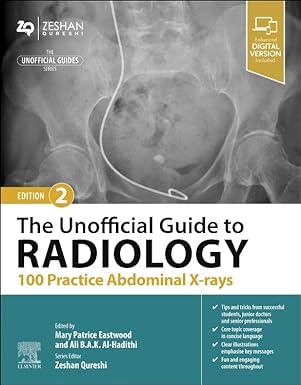 The Unofficial Guide to Radiology: 100 Practice Abdominal X Rays: 3ed