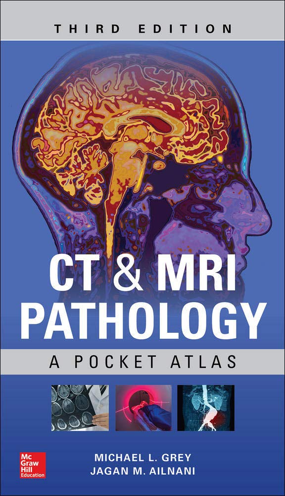 CT & MRI PATHOLOGY: A POCKET ATLAS