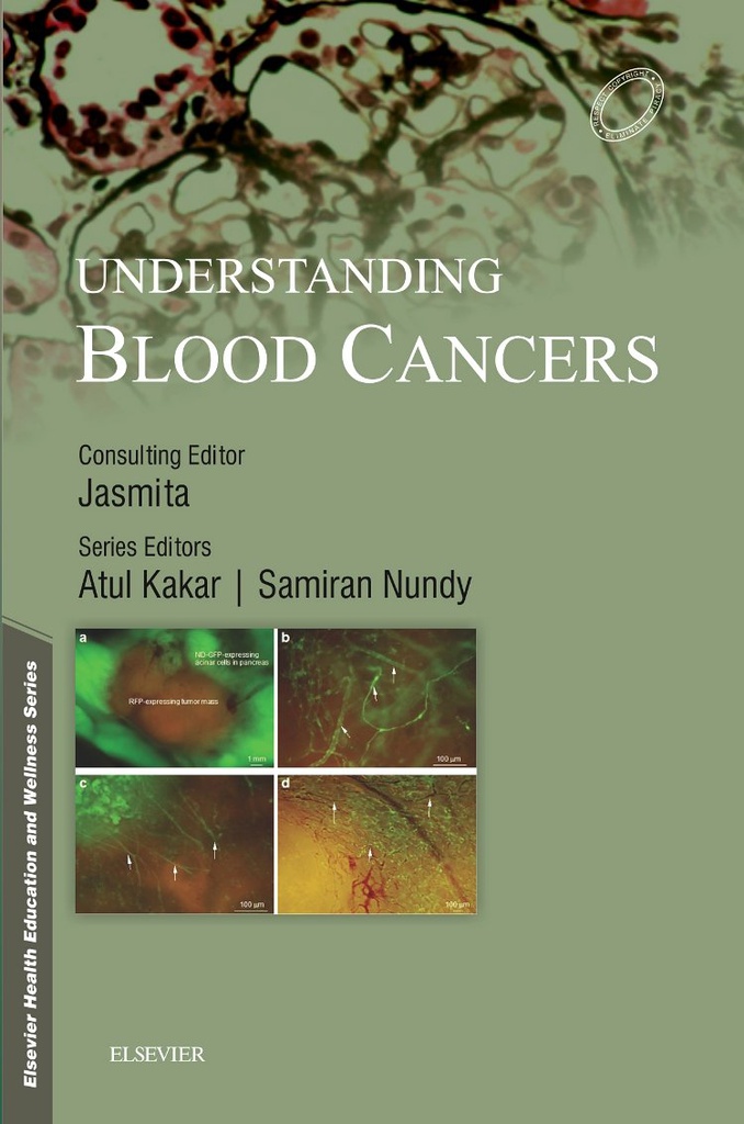 Understanding Blood Cancers, 1/e