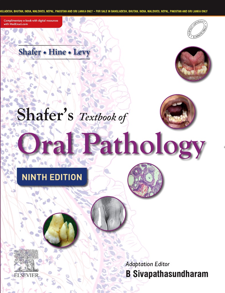 Shafer's Textbook of Oral Pathology, 9/e