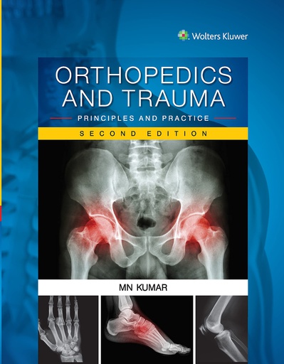 [B9789351295082] Orthopedics and Trauma: Principles and Practice, 2/e