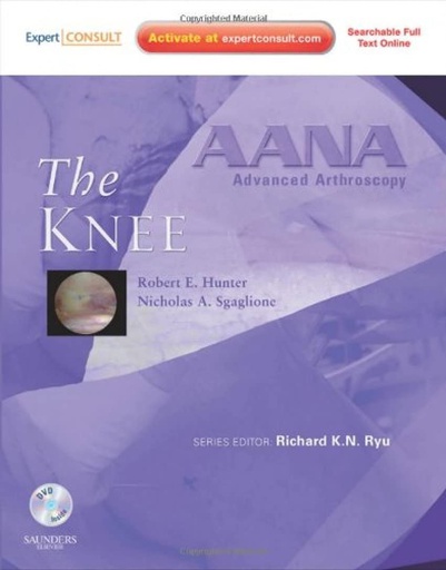 [B9781437706642] AANA Advanced Arthroscopy: The Knee: Expert Consult: Online, Print and DVD 1ed