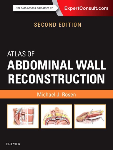 [B9780323374590] Atlas of Abdominal Wall Reconstruction: 2ed