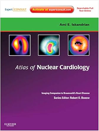 [B9781416061342] Atlas of Nuclear Cardiology: Imaging Companion to Braunwald's Heart Disease: Expert Consult - Online and Print 1ed