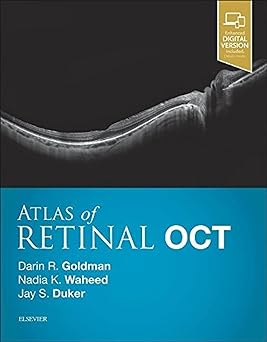 [B9780323461214] Atlas of Retinal OCT: Optical Coherence Tomography: 1ed