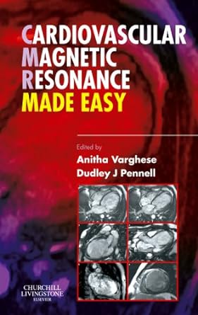 [B9780443103018] Cardiovascular Magnetic Resonance Made Easy: 1ed