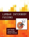 Lumbar Interbody Fusions: 1ed