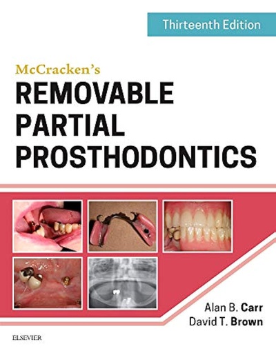 [B9780323339902] McCracken's Removable Partial Prosthodontics: 13ed