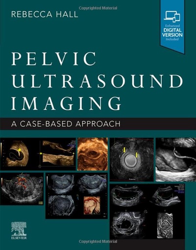 [B9780323789783] Pelvic Ultrasound Imaging: A Cased-Based Approach 1ed