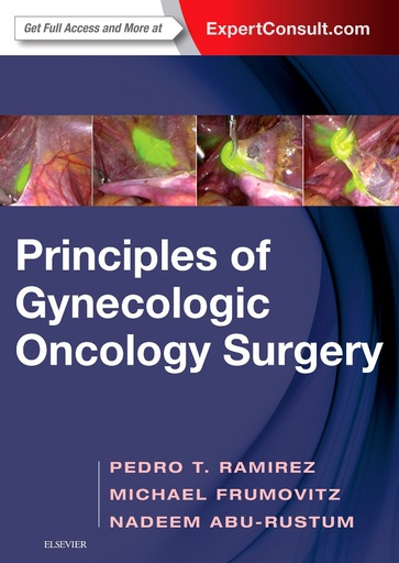 [B9780323428781] Principles of Gynecologic Oncology Surgery: 1ed