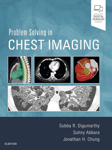 [B9780323041324] Problem Solving in Chest Imaging: 1ed