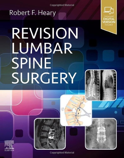 [B9780323712019] Revision Lumbar Spine Surgery: 1ed