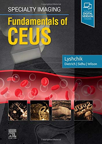 [B9780323625647] Specialty Imaging: Fundamentals of CEUS: 1ed