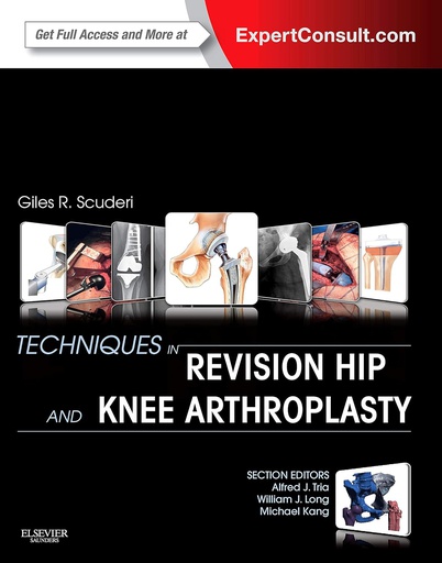 [B9781455723683] Techniques in Revision Hip and Knee Arthroplasty: 1ed