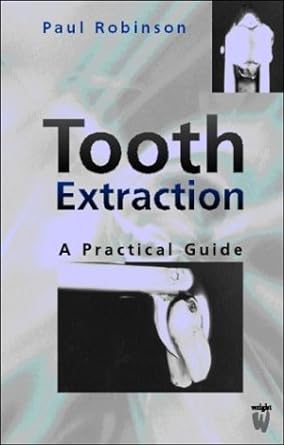 [B9780723610717] Tooth Extraction: A Practical Guide 1ed