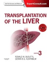 Transplantation of the Liver: 3ed