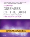 Andrews' Diseases of the Skin: Clinical Dermatology, IE, 13/e