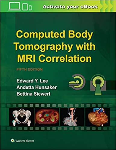 [B9789389702330] Computed Body Tomography with MRI Correlation