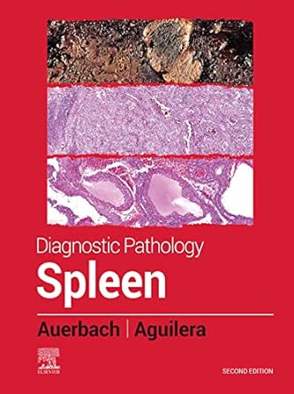 [B9780323830126] Diagnostic Pathology: Spleen: 2ed