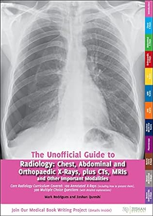 [B9780957149946] Unofficial Guide to Radiology: Chest, Abdominal and Orthopaedic X Rays, Plus CTs, MRIs and Other Important Modalities: Core Radiology Curriculum 1ed
