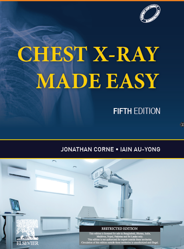 [B9788131268926] Chest X-Ray Made Easy, 5e