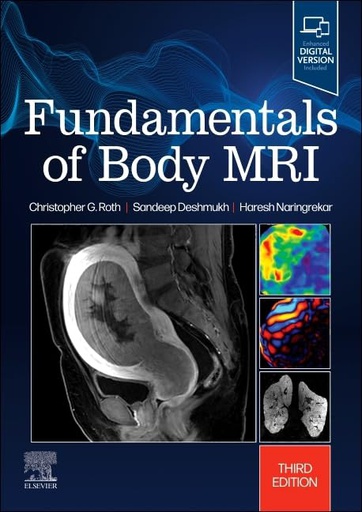 [B9780323833813] Fundamentals of Body MRI: 3ed