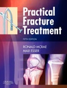 Practical Fracture Treatment: 5ed